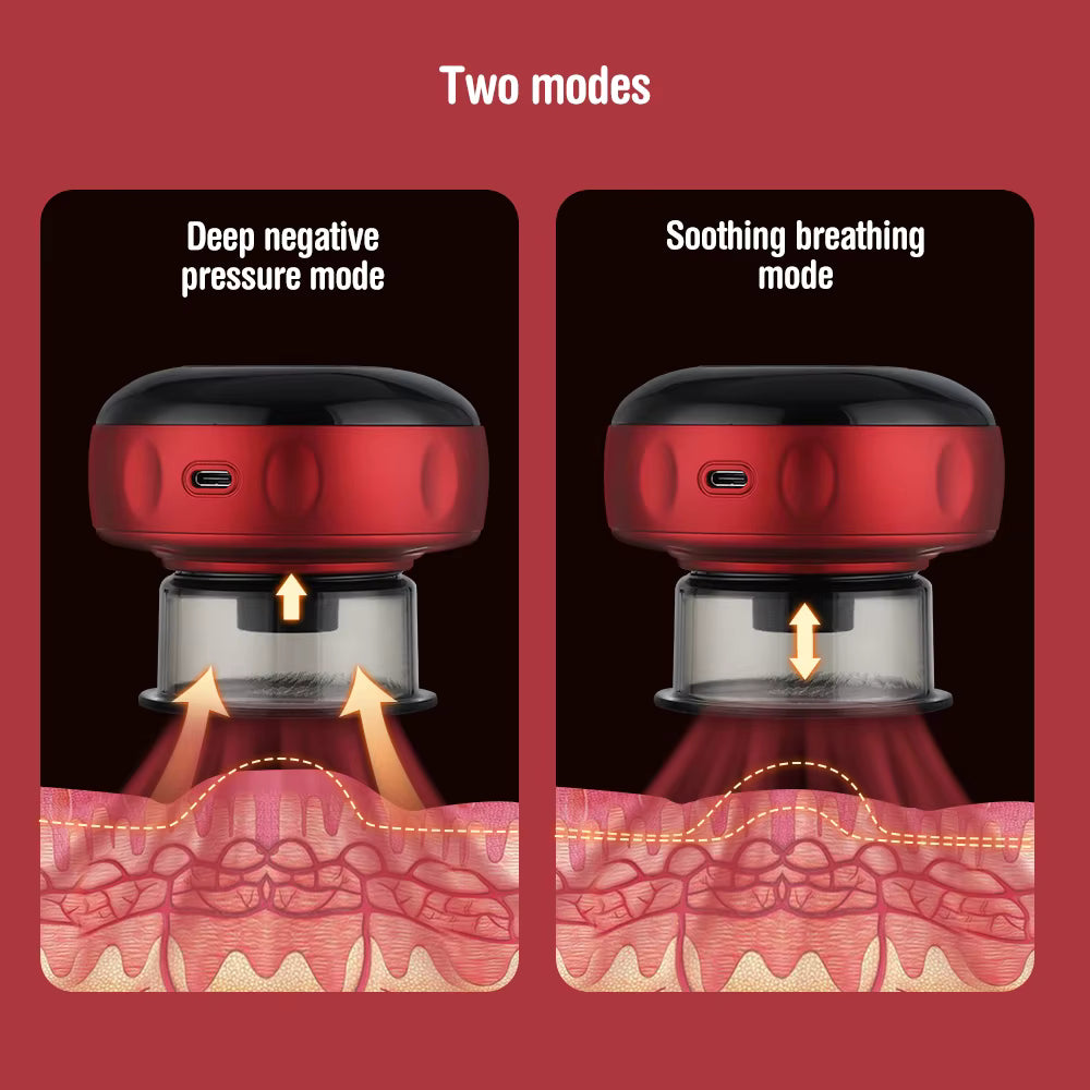 Cuppora™ Smart Heated Cupping Massager